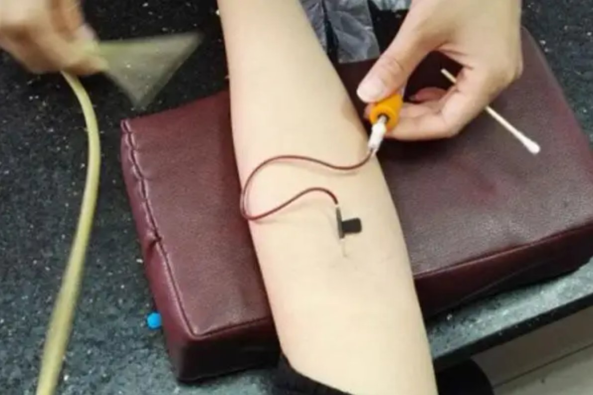 B型血分为几种类型？