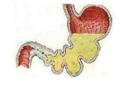 潴留是什么意思？