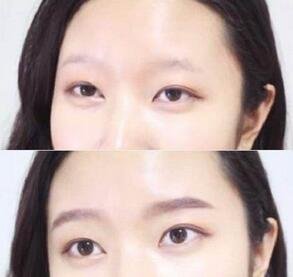 对于眼下的“医疗美容热”，人民日报有何评价？