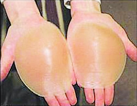 乳房炸弹的专家解密