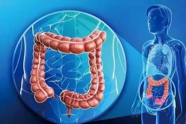 一家10口7人患肠癌，哪些情况会引发肠癌的发生率？