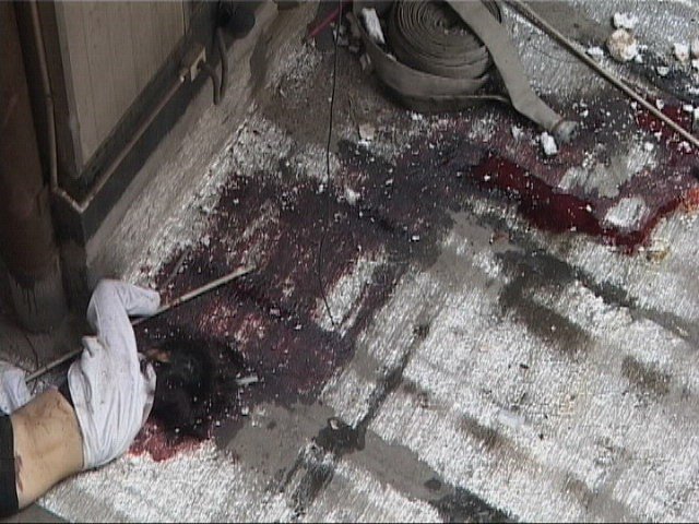 血肉模糊是怎样一个地步