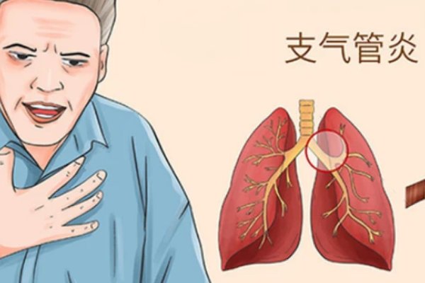 法语souffle什么意思