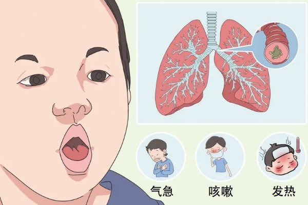 法语souffle什么意思