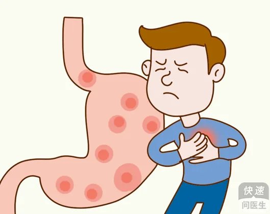 奥美拉唑胶囊治疗胃炎吗？要区别胃炎类型