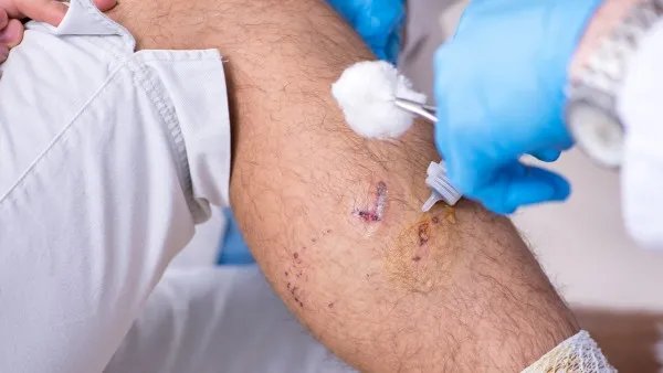 纳洛酮说明书用法用量 盐酸纳洛酮注射液多少钱一盒