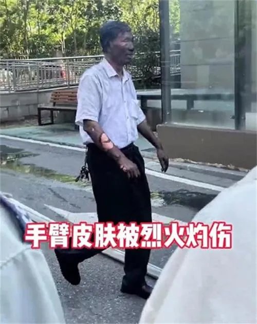 70岁保安冲入火场救火被灼成雕像 不畏生死