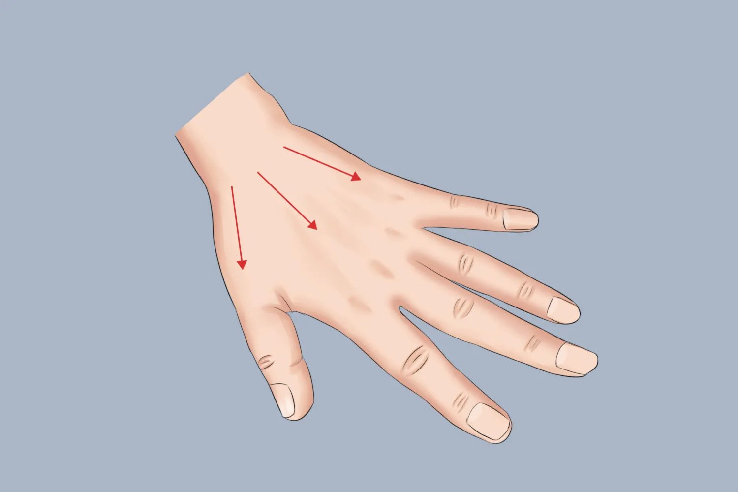 正确的手部刮痧方向图