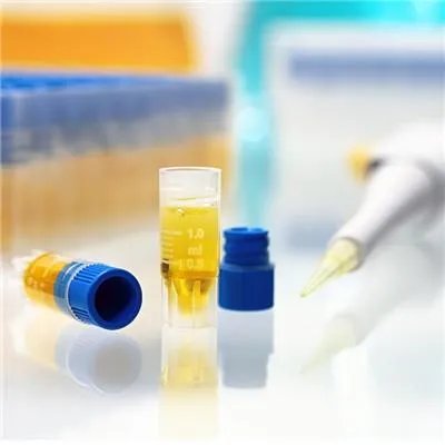 白蛋白高是怎么回事