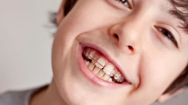 晚上睡觉磨牙怎么办