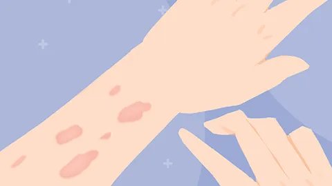 小腿痒痒越挠越痒是什么原因