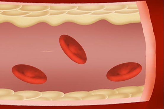 血小板分布宽度偏高是什么意思