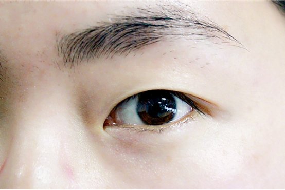 眼保健操怎么做