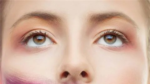 北京眼部整形多少钱