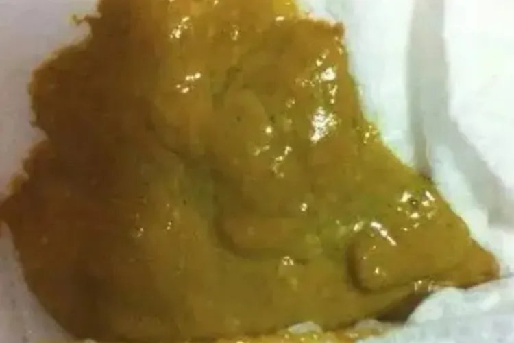 新生儿便便图片分析