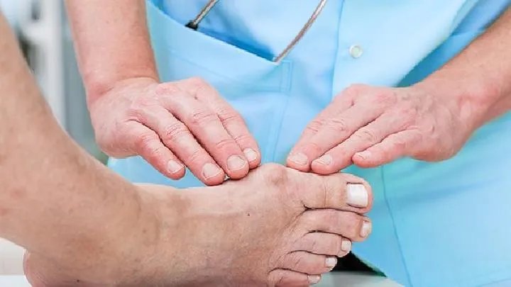 日本血吸虫病应该做哪些检查？