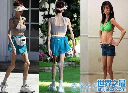 世界上最丑陋的女人，世界上20个最丑的人(怕吐勿看) 