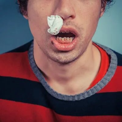 治鼻炎那里最好