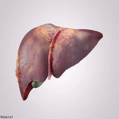 肝内胆管结石怎么得的