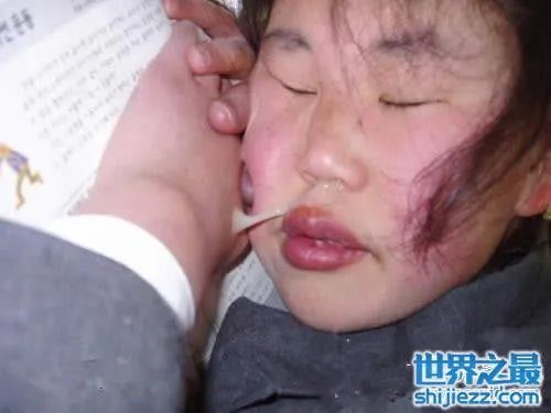 世界上最丑陋的女人，世界上20个最丑的人(怕吐勿看) 