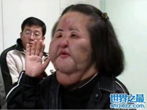 世界上最丑陋的女人，世界上20个最丑的人(怕吐勿看) 