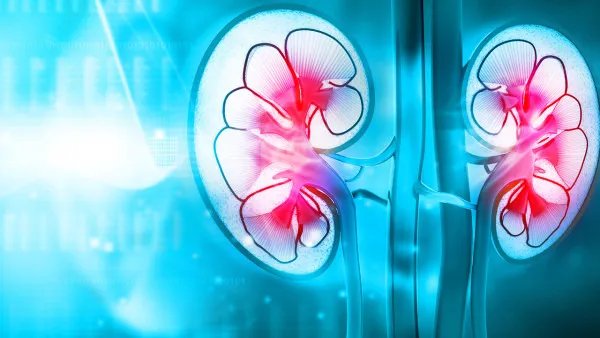 肾钙化是什么意思