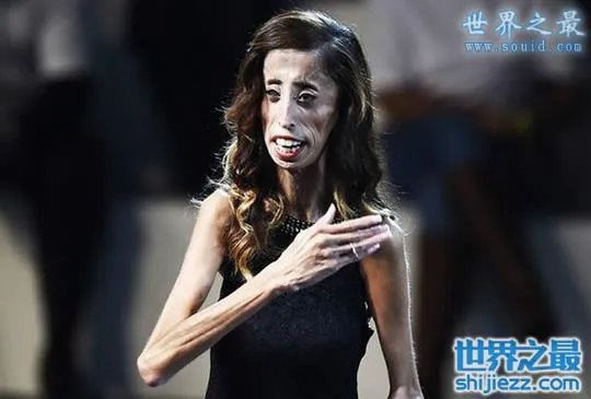 世界上最丑陋的女人，世界上20个最丑的人(怕吐勿看) 