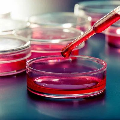 地中海贫血有哪些症状？