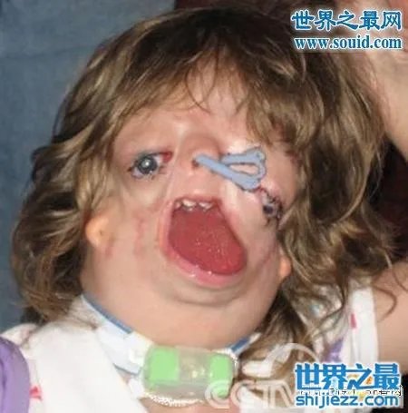 世界上最丑陋的女人，世界上20个最丑的人(怕吐勿看) 