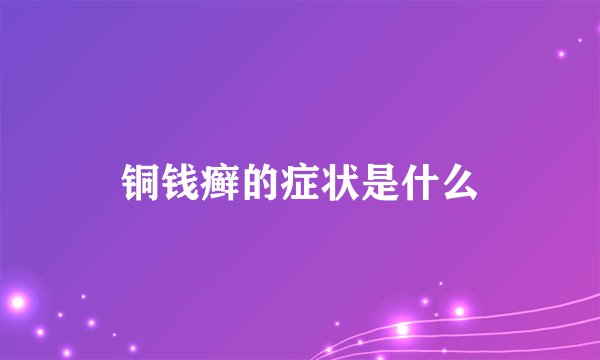 铜钱癣的症状是什么