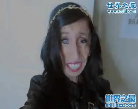 世界上最丑陋的女人，世界上20个最丑的人(怕吐勿看) 