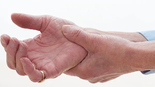 手麻木是怎么回事