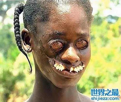 世界上最丑陋的女人，世界上20个最丑的人(怕吐勿看) 