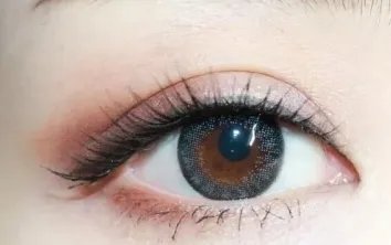 韩式三点定位双眼皮多少钱