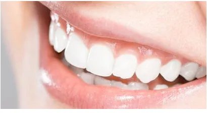 种植牙要多少钱一个