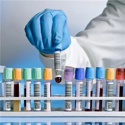 红细胞压积偏高什么原因