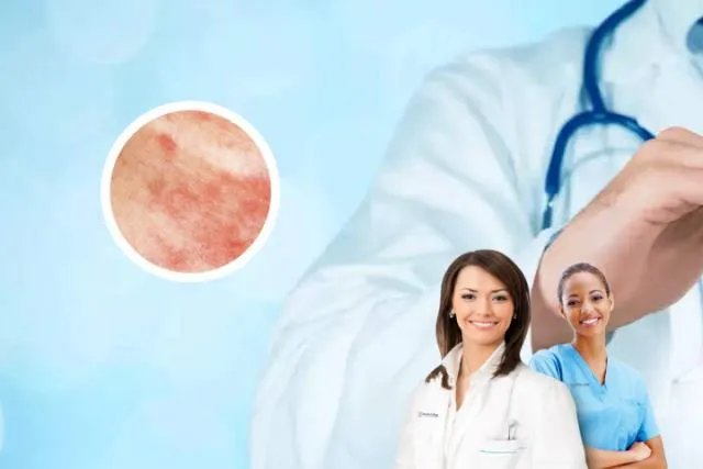 皮肤病 拍图识别-皮肤病图片识别