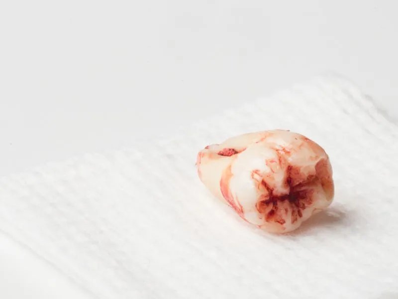 为什么会长智齿