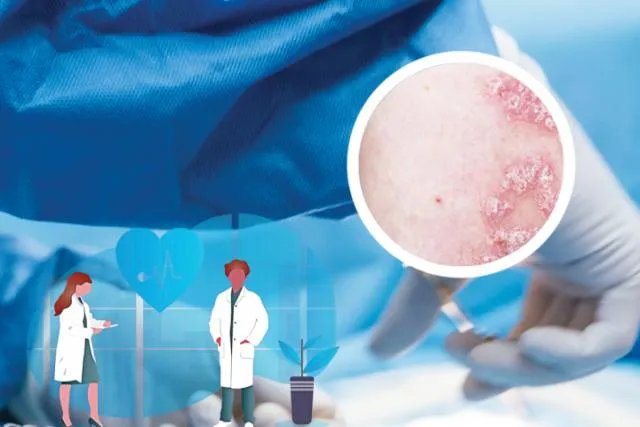 扫一扫识别皮肤病_拍照看图识别皮肤病图解