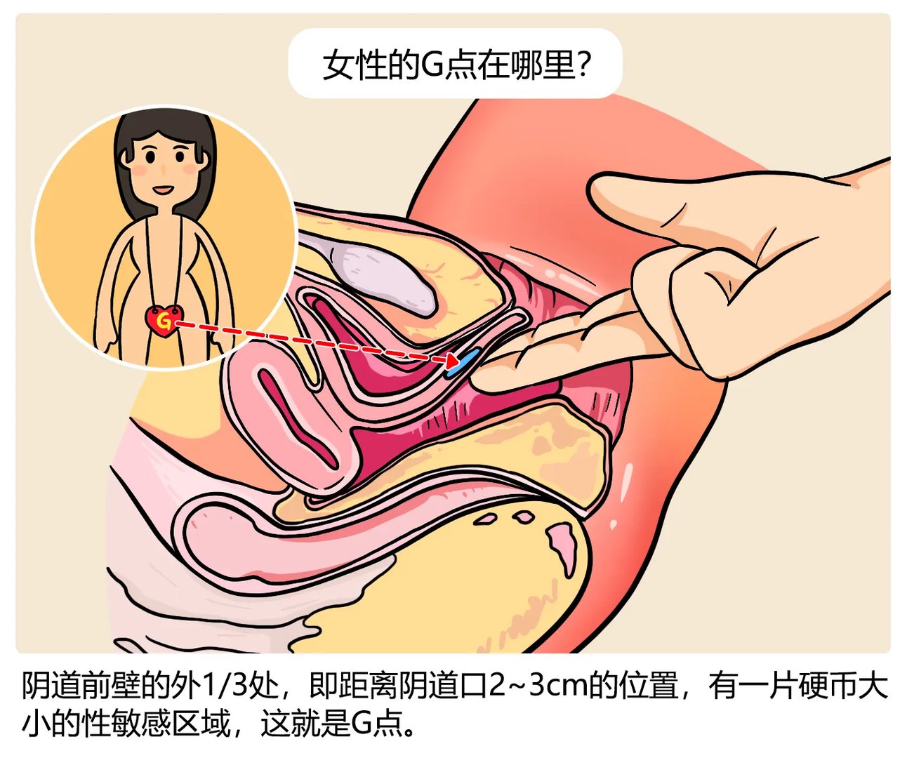 女性的G点在哪里