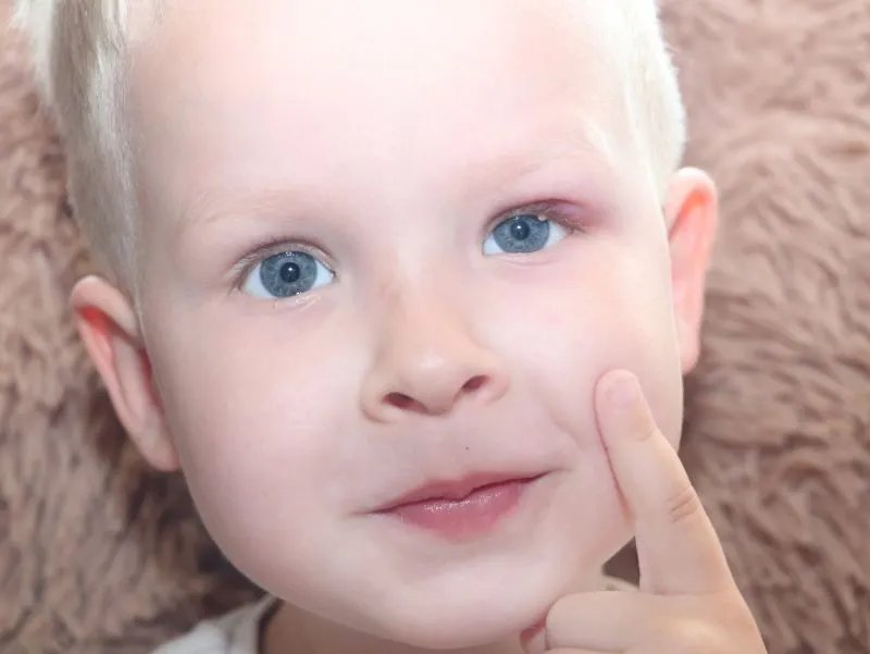 眼球疼怎么回事