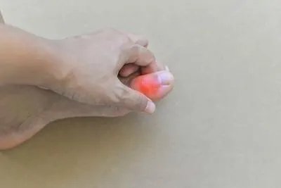 腱鞘囊肿是怎么回事呢