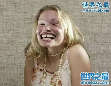 世界上最丑陋的女人，世界上20个最丑的人(怕吐勿看) 