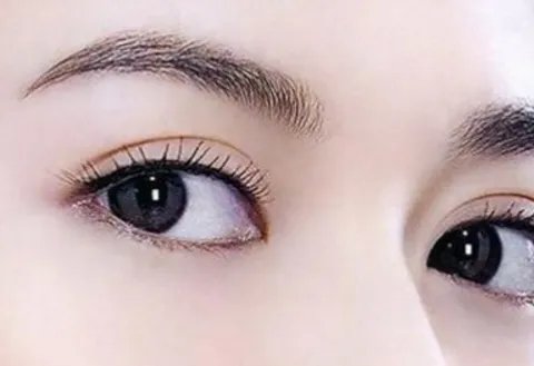 眼部微整形的价格