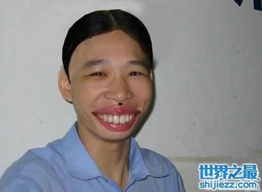 世界上最丑陋的女人，世界上20个最丑的人(怕吐勿看) 