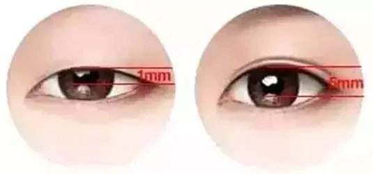 合肥立体纹眉有哪些靠前的美容整形医院榜单曝光!看一看不吃亏!