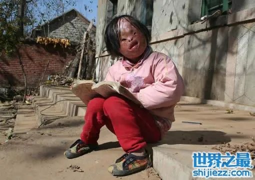 世界上最丑陋的女人，世界上20个最丑的人(怕吐勿看) 