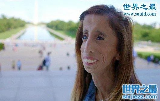 世界上最丑陋的女人，世界上20个最丑的人(怕吐勿看) 