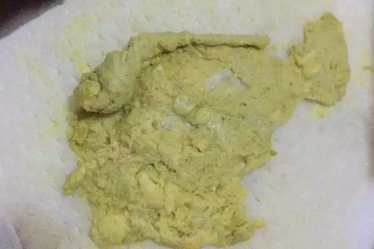 新生儿便便图片分析