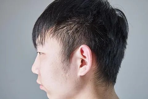 轻微脑震荡怎么办